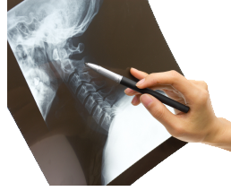 Craniosacral Therapy